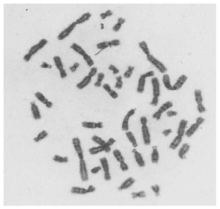 Cross chromosome image instance segmentation method based on chromosome trisection feature point positioning
