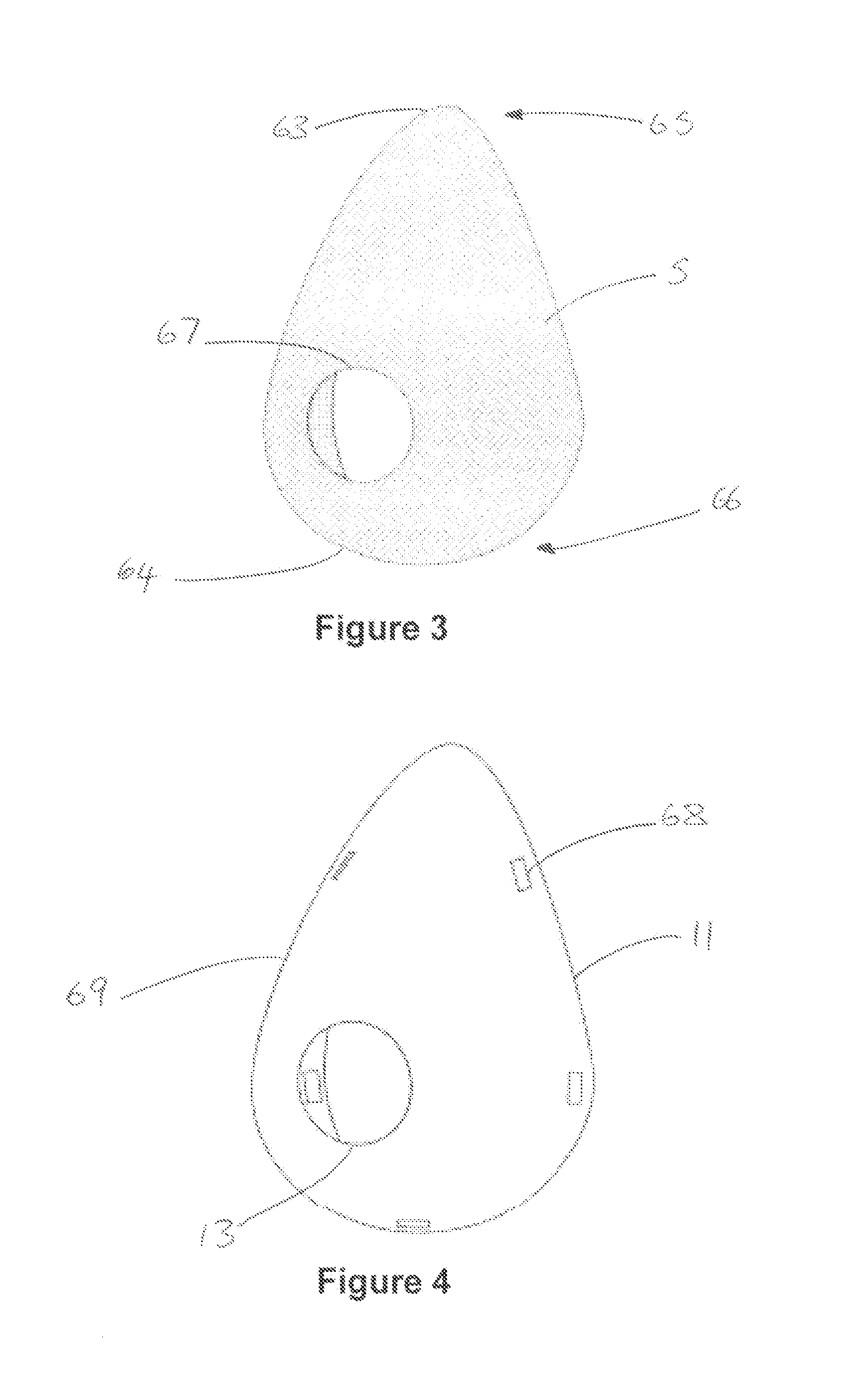 Human mammary prosthetic support and method of implanting
