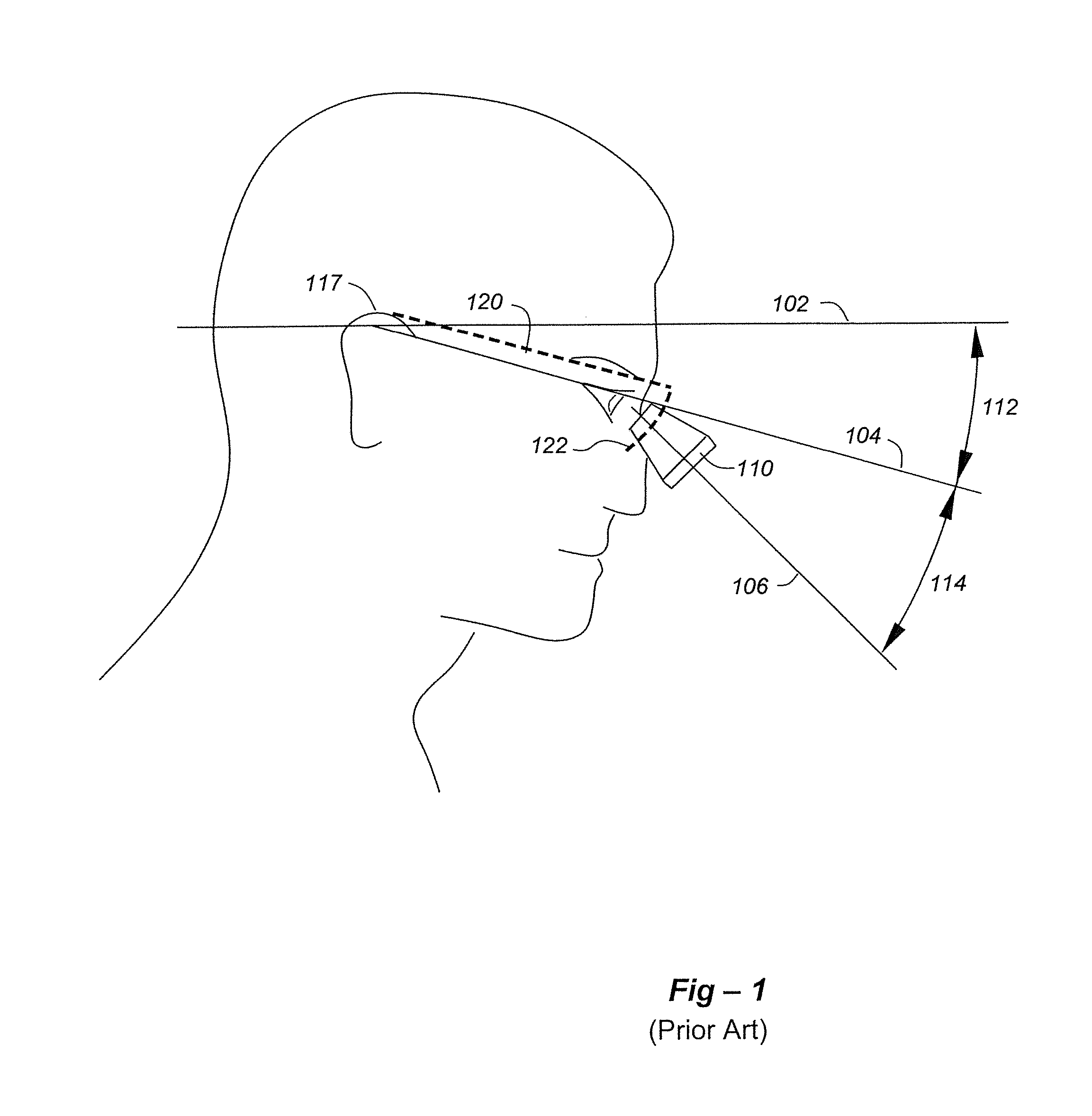 Through-the-lens (TTL) loupes with improved declination angle