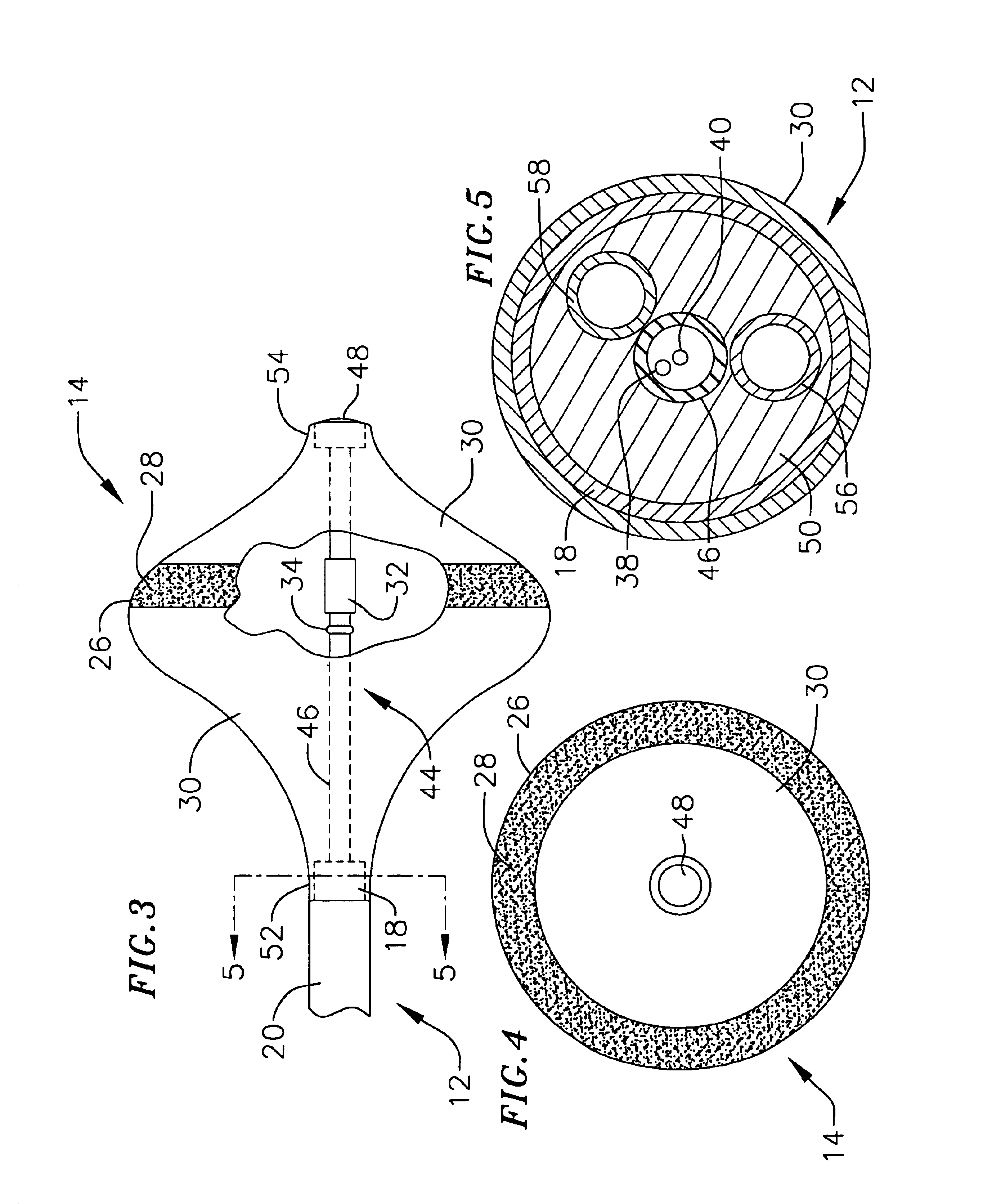 Surgical probe for supporting inflatable therapeutic devices in contact with tissue in or around body orifices and within tumors