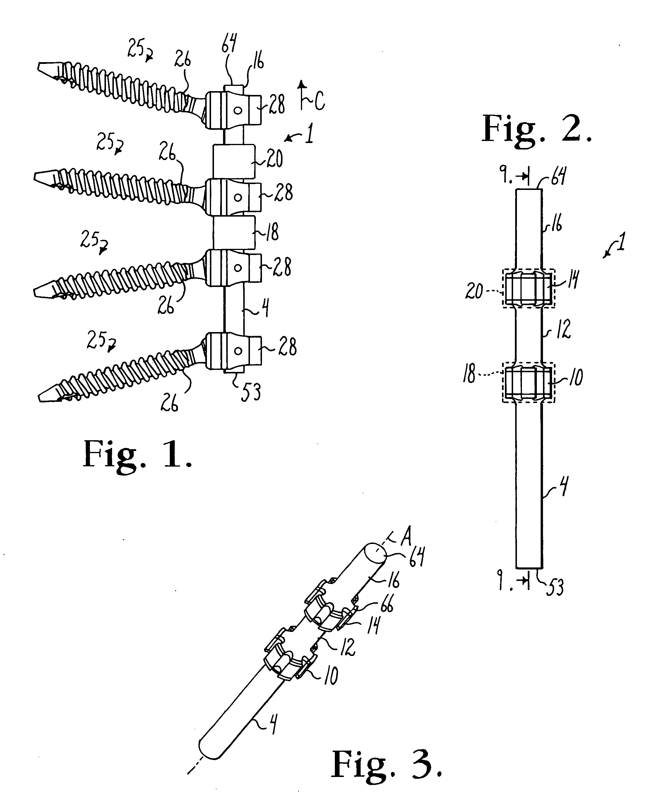 Dynamic stabilization connecting member with floating core, compression spacer and over-mold