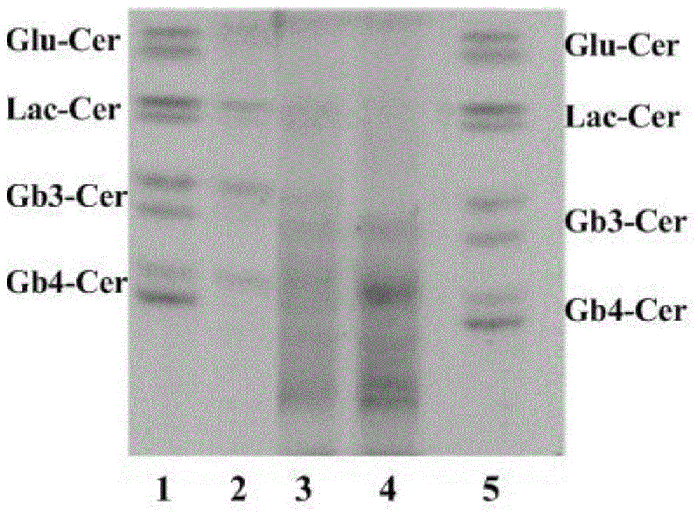 Anti-human glycosphingolipid Globo-H monoclonal antibody and preparation method and application thereof