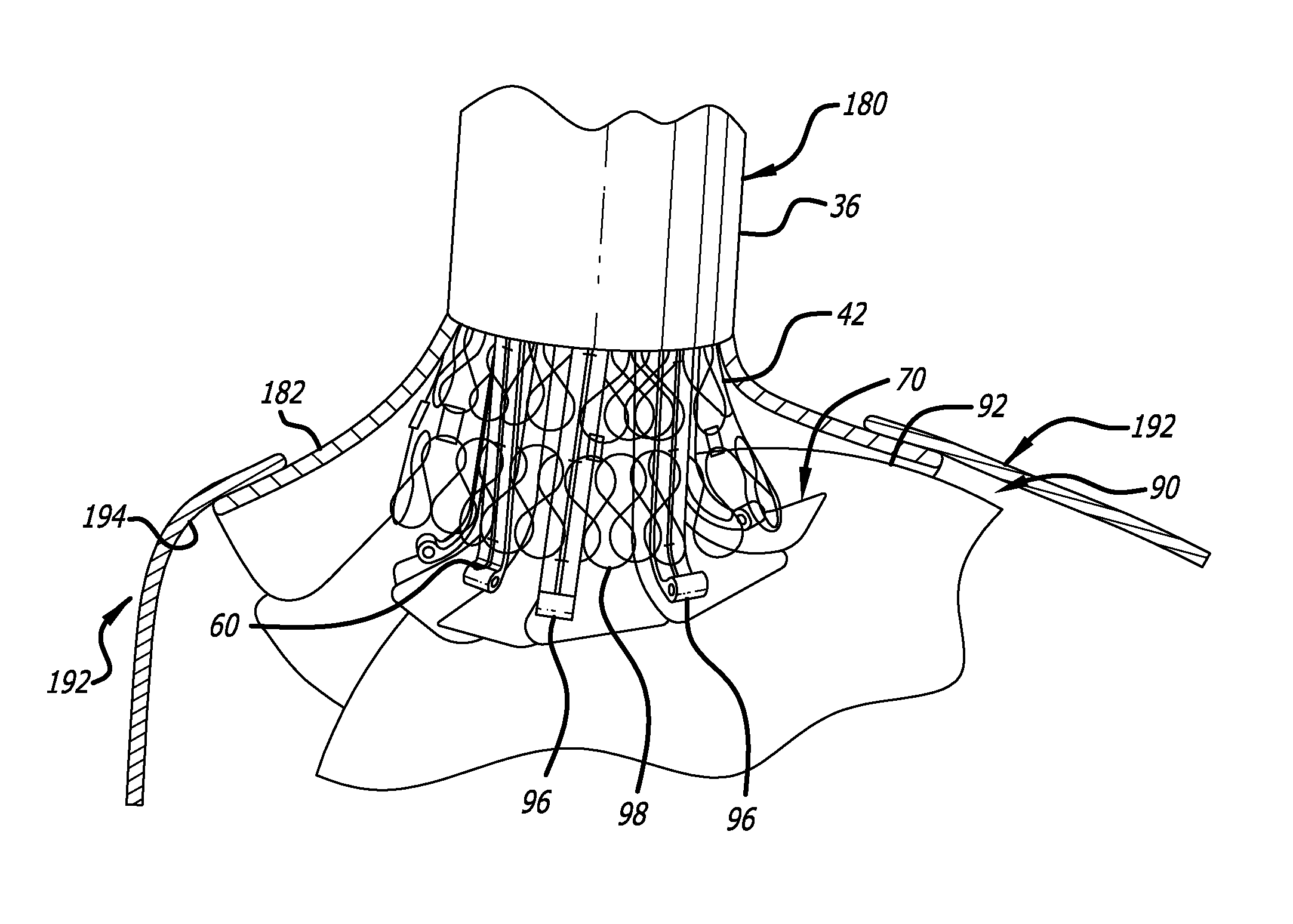 Medical device delivery system having integrated introducer