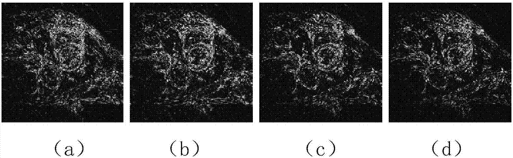 Sorting structure group nonconvex constraint-based CS-MRI image reconstruction method