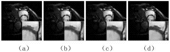 Sorting structure group nonconvex constraint-based CS-MRI image reconstruction method