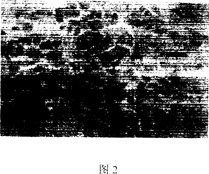 Method for planting esoderma/endothelial cell on inner surface of artificial blood vessel