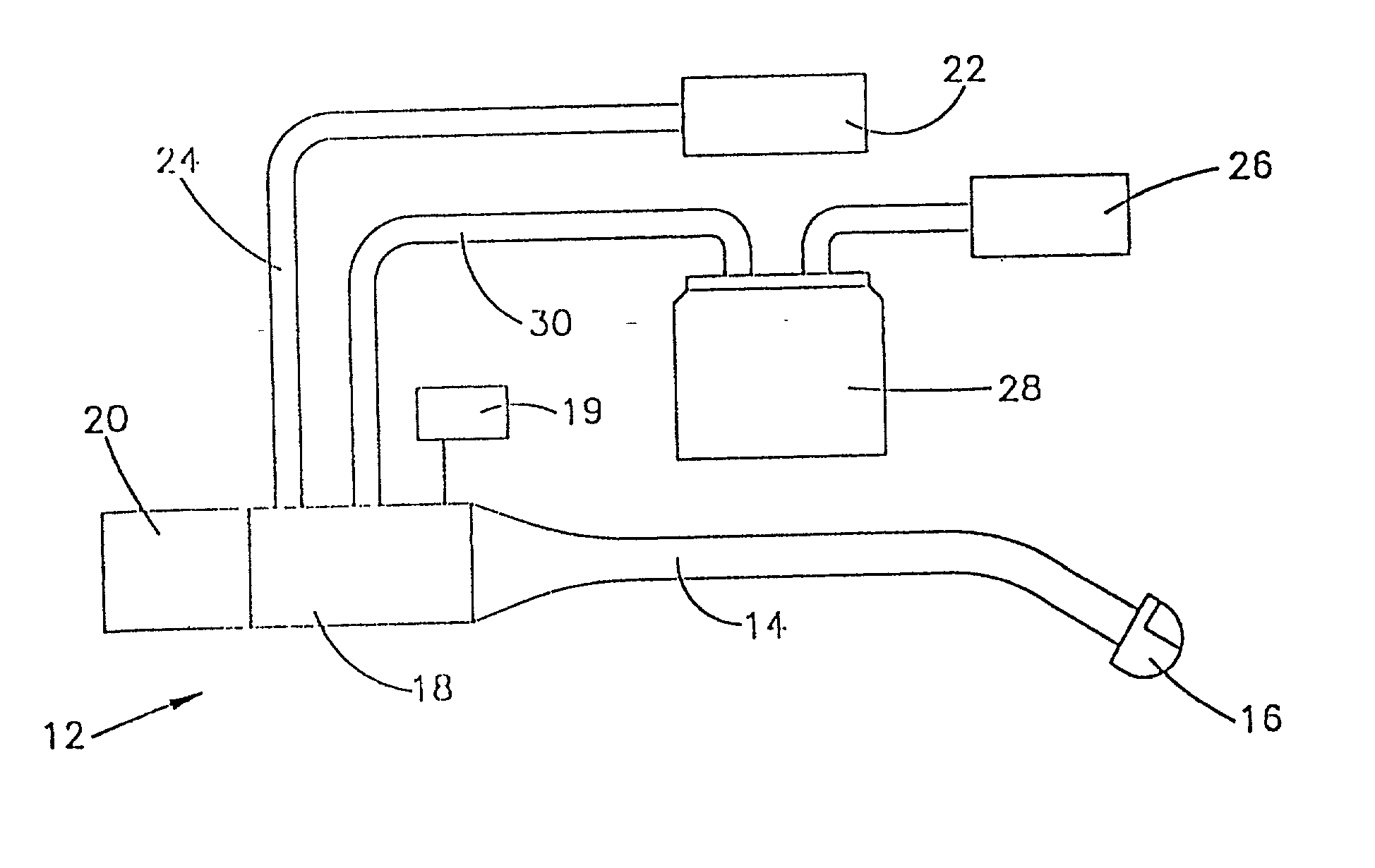 Apparatus and method for tissue removal