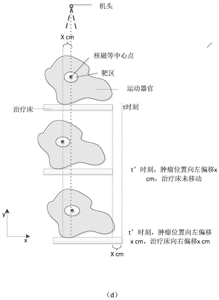 A nuclear magnetic image guided radiotherapy equipment and storage medium