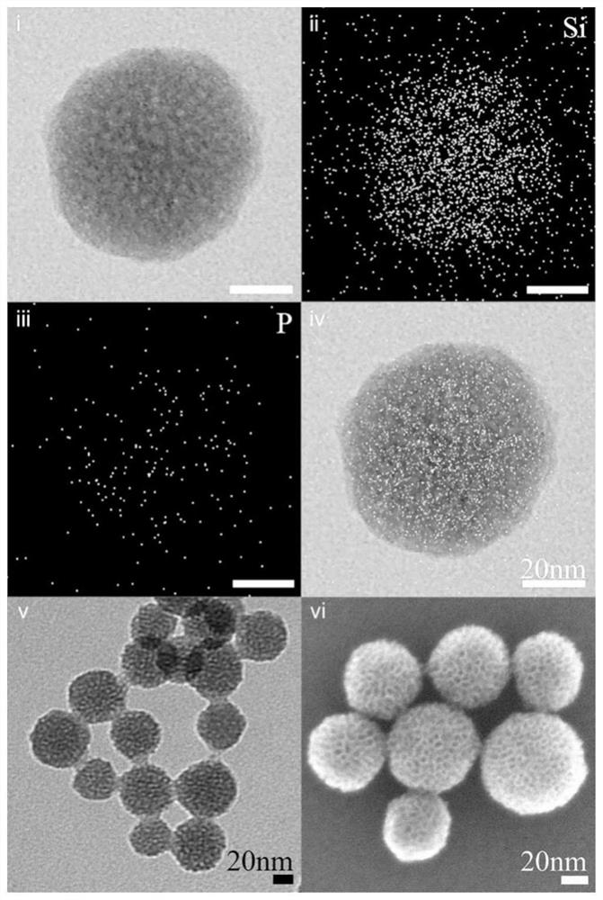 Nano-drug for treating osteoporosis as well as preparation method and application of nano-drug