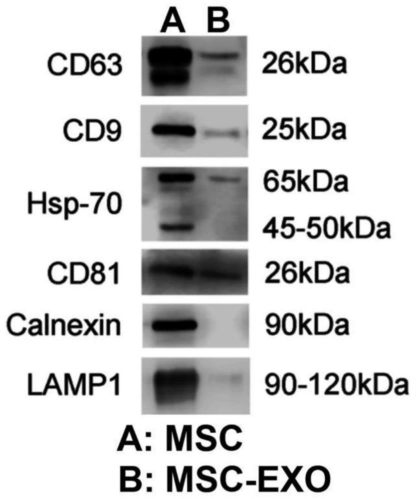 Method for rapidly increasing exosome yield of adipose tissue-derived stromal cells