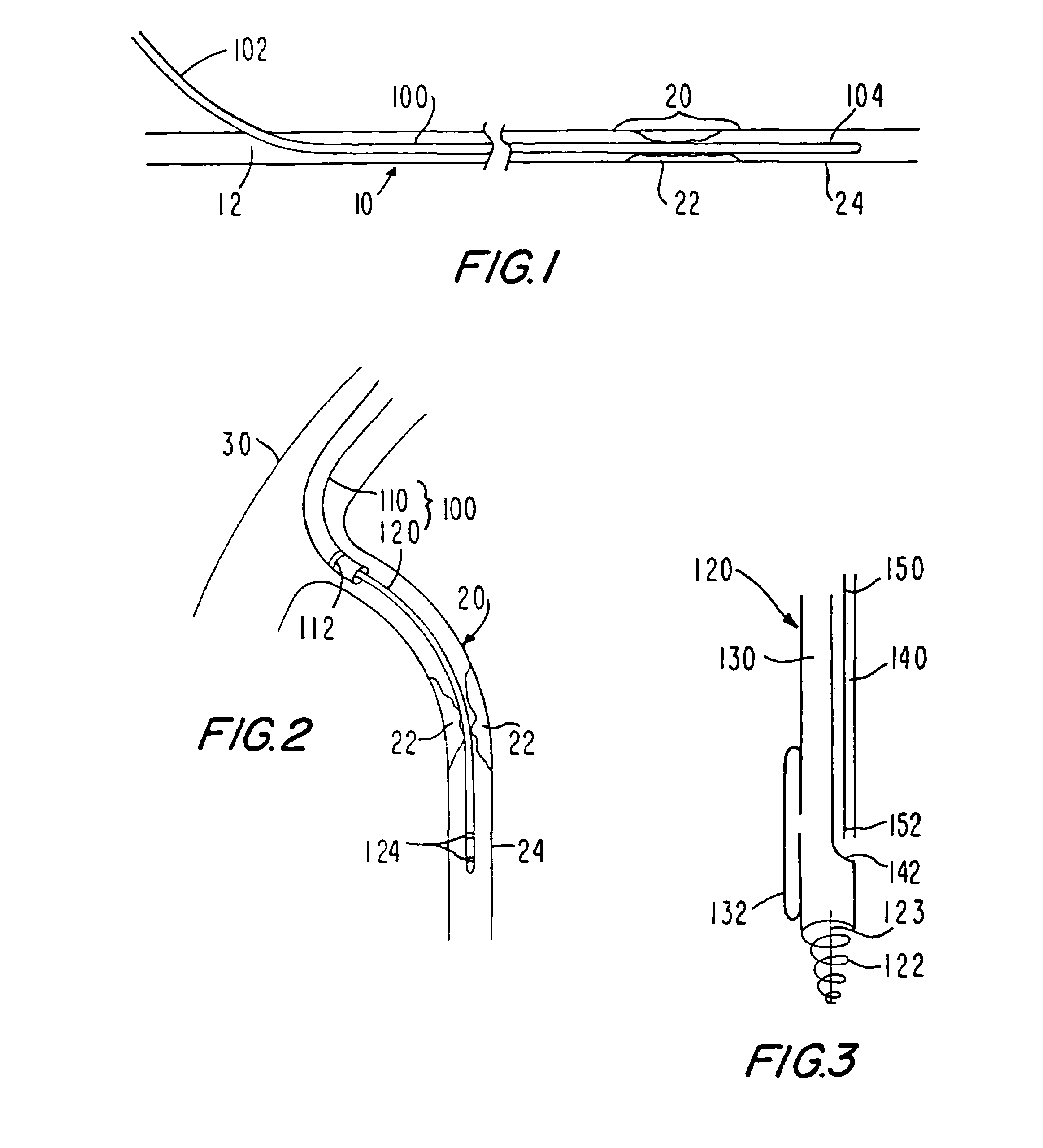 Medical grafting connectors and fasteners