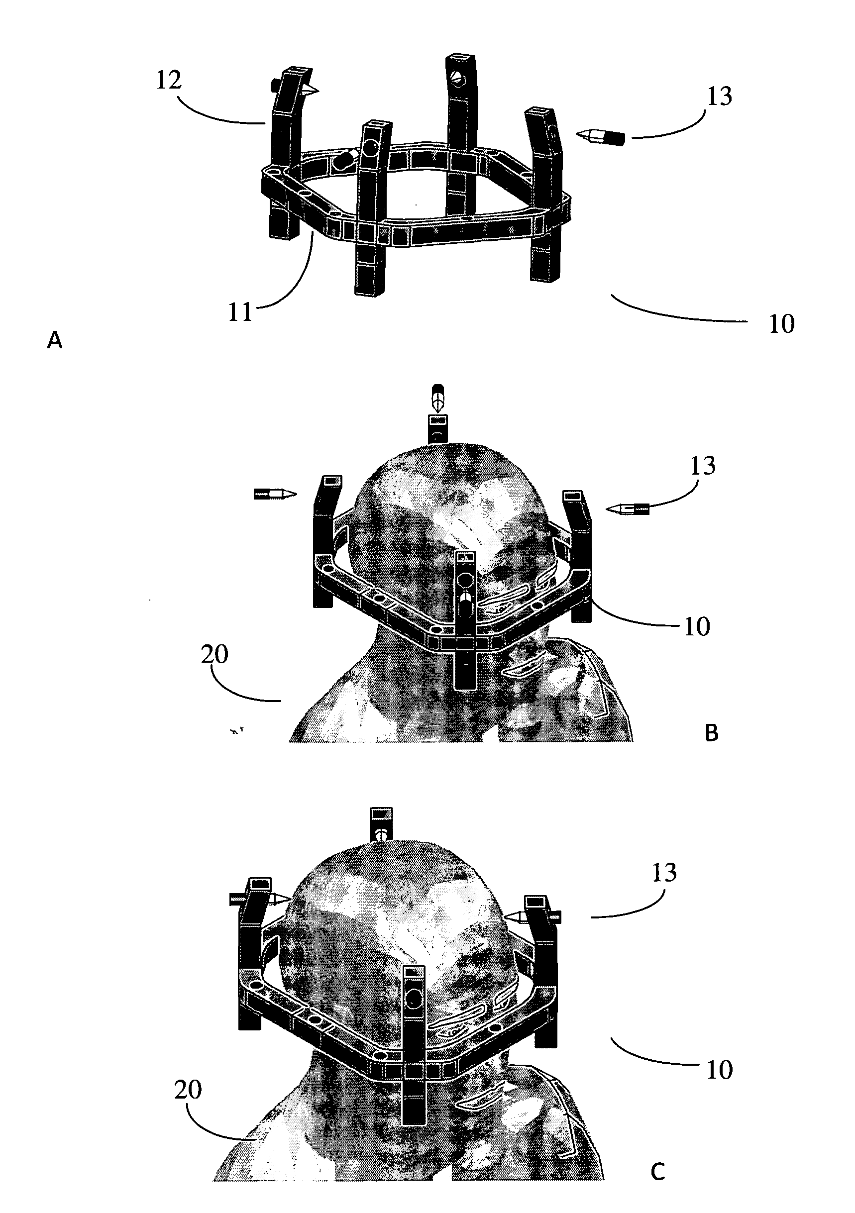 Devices and methods for positioning a stereotactic frame