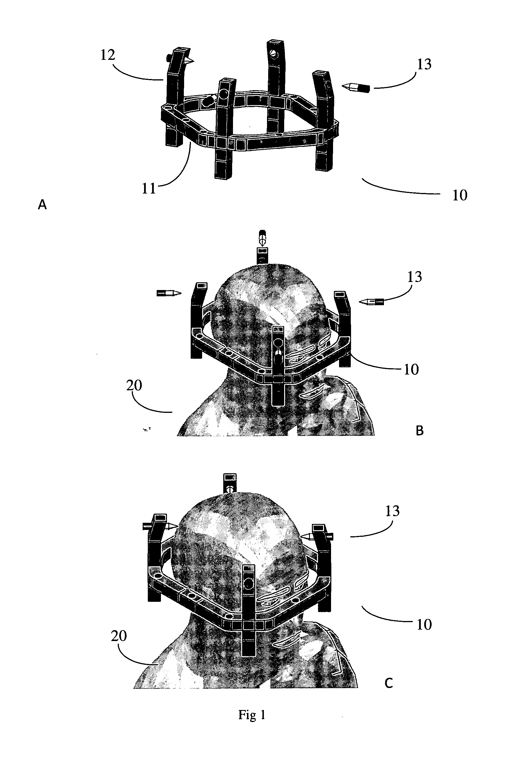 Devices and methods for positioning a stereotactic frame