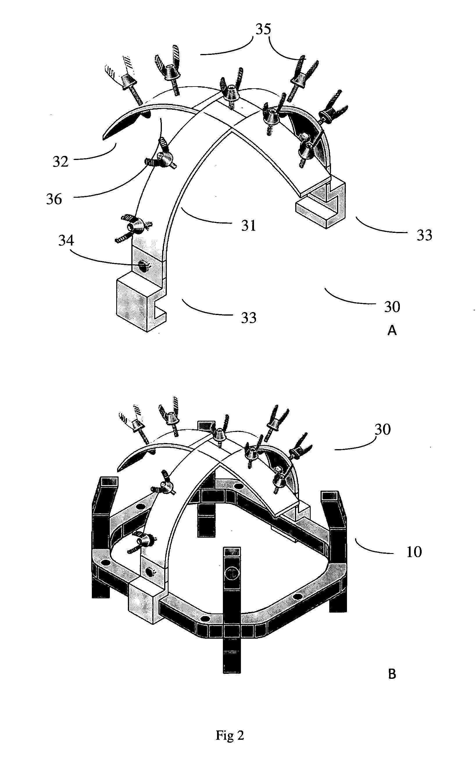 Devices and methods for positioning a stereotactic frame