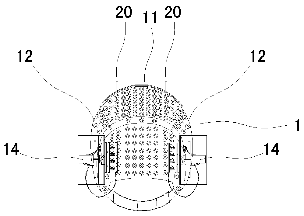 Therapeutic apparatus for nervous tinnitus, deafness, tinnitus cerebri (tinnitus cranii)