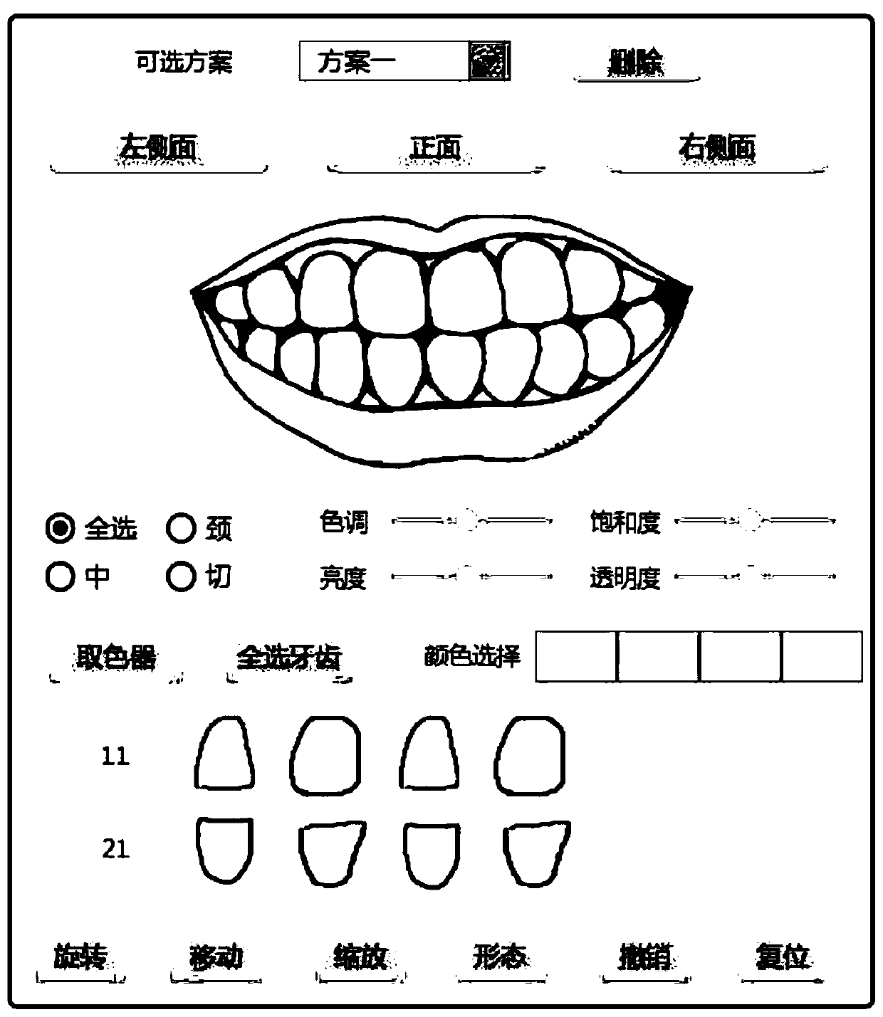 AR intelligent assistant method for tooth beautification based on c/s architecture