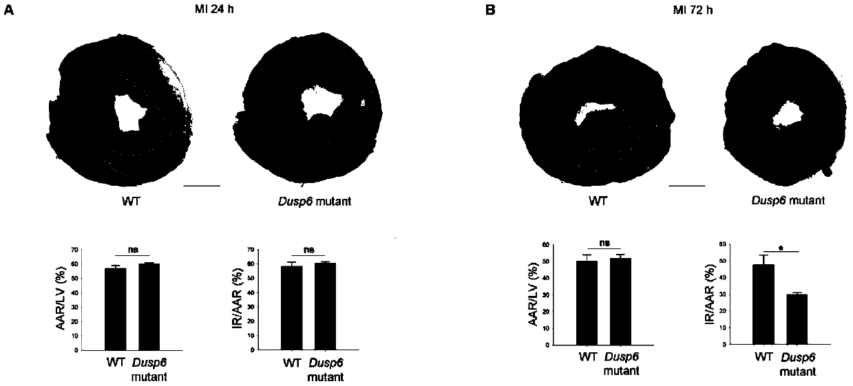 Target DUSP6 related to myocardial infarction diagnosis and treatment and application thereof