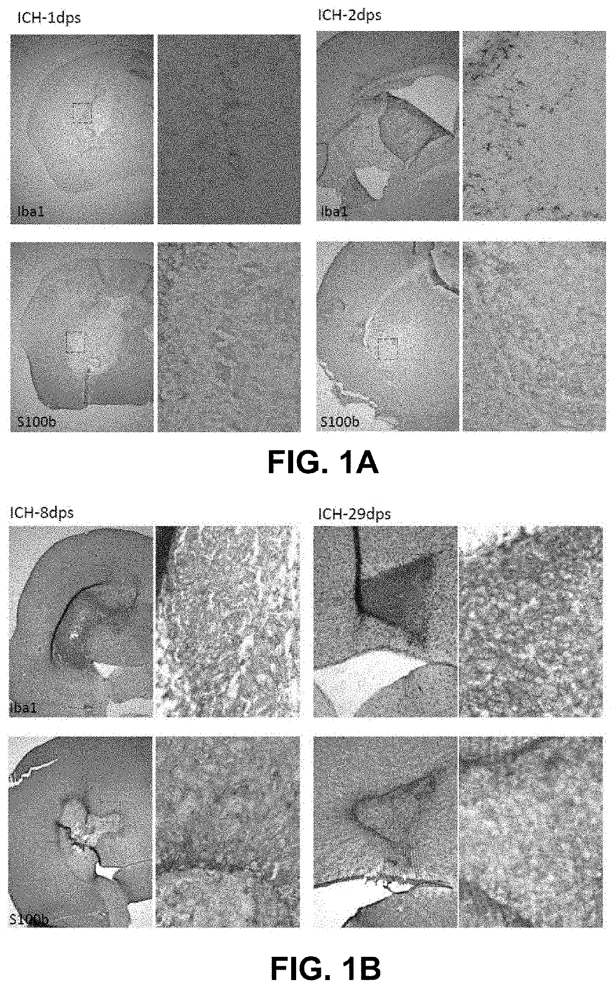 Regenerating functional neurons for treatment of hemorrhagic stroke