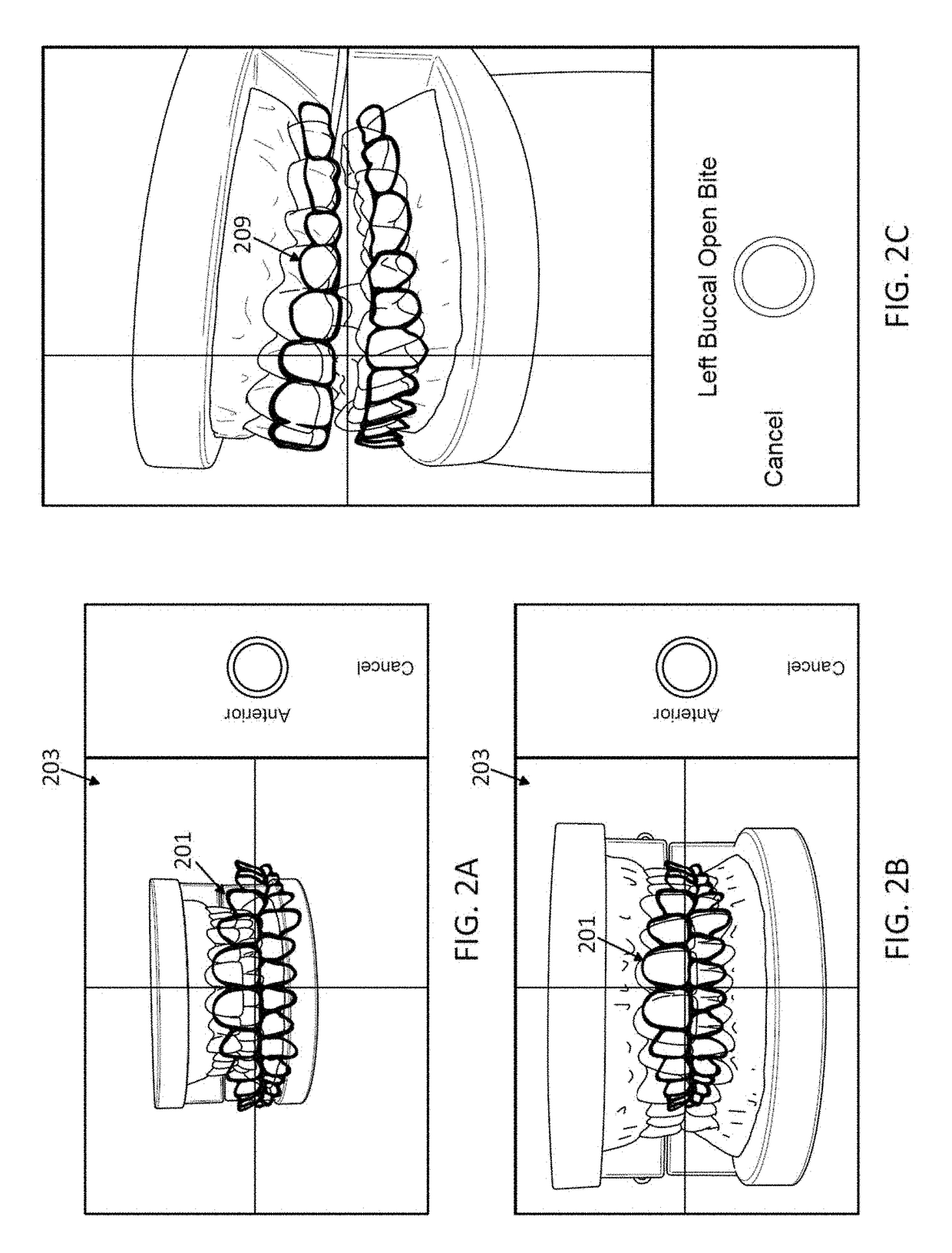 Methods and apparatuses for dental images