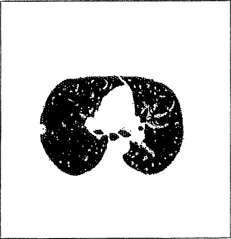 Method and device for forming an isolated visualization of body structures