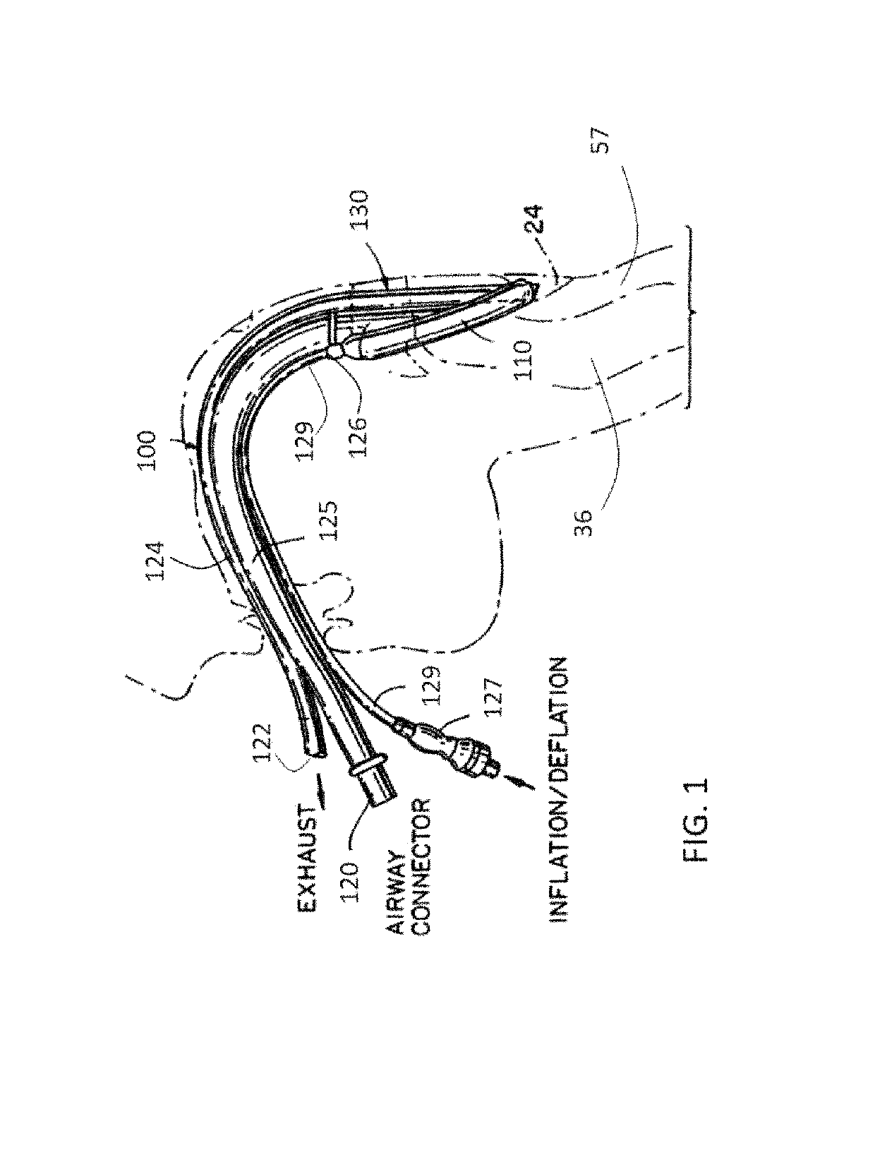 Laryngeal mask cuff