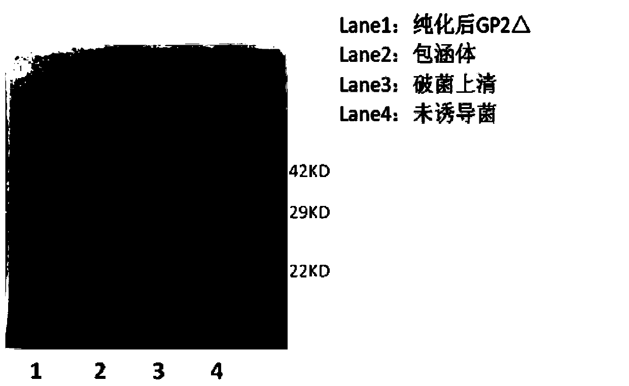 Antigen fragments, truncations and applications based on Marburg virus envelope protein