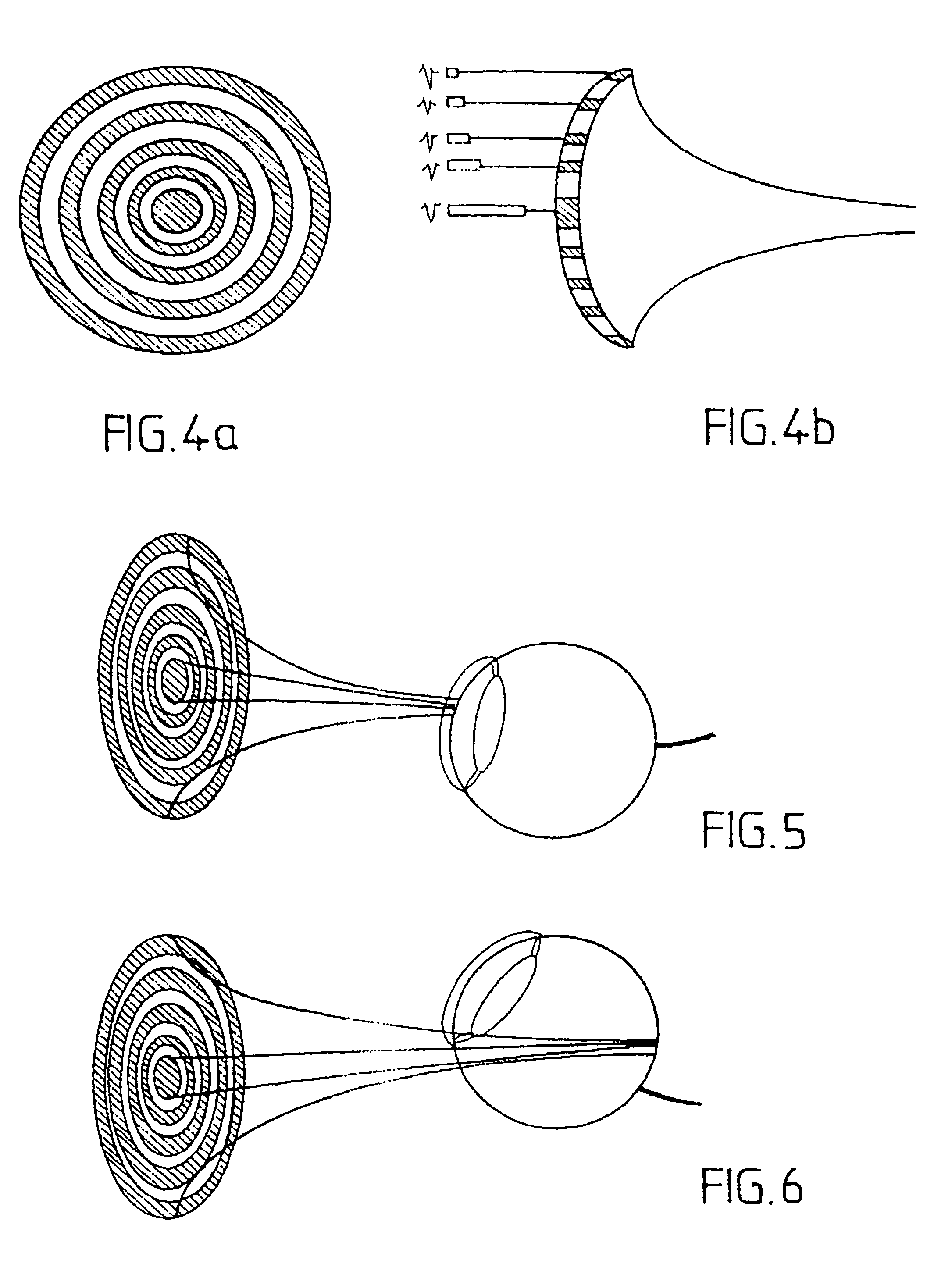 Method for exploring and displaying tissue of human or animal origin from a high frequency ultrasound probe