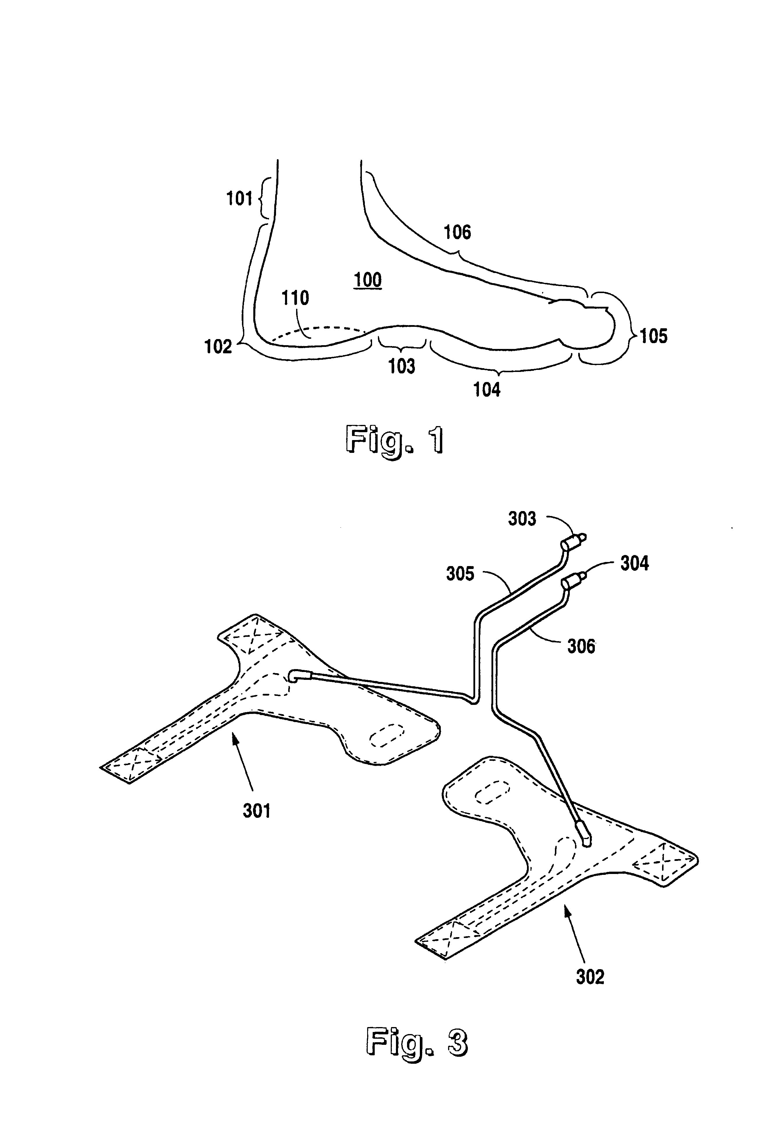 Therapeutic apparatus for treating ulcers