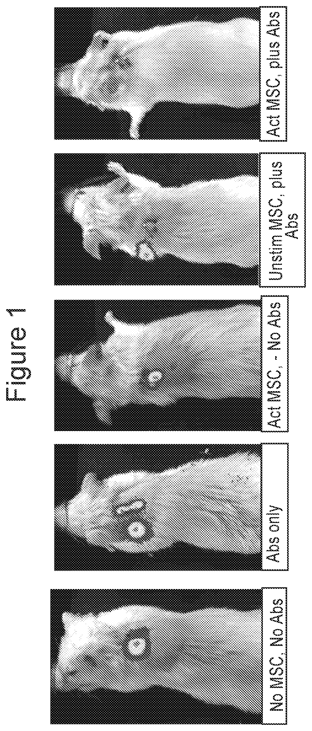 Activated stem cells and systemic treatment methods for infected wounds