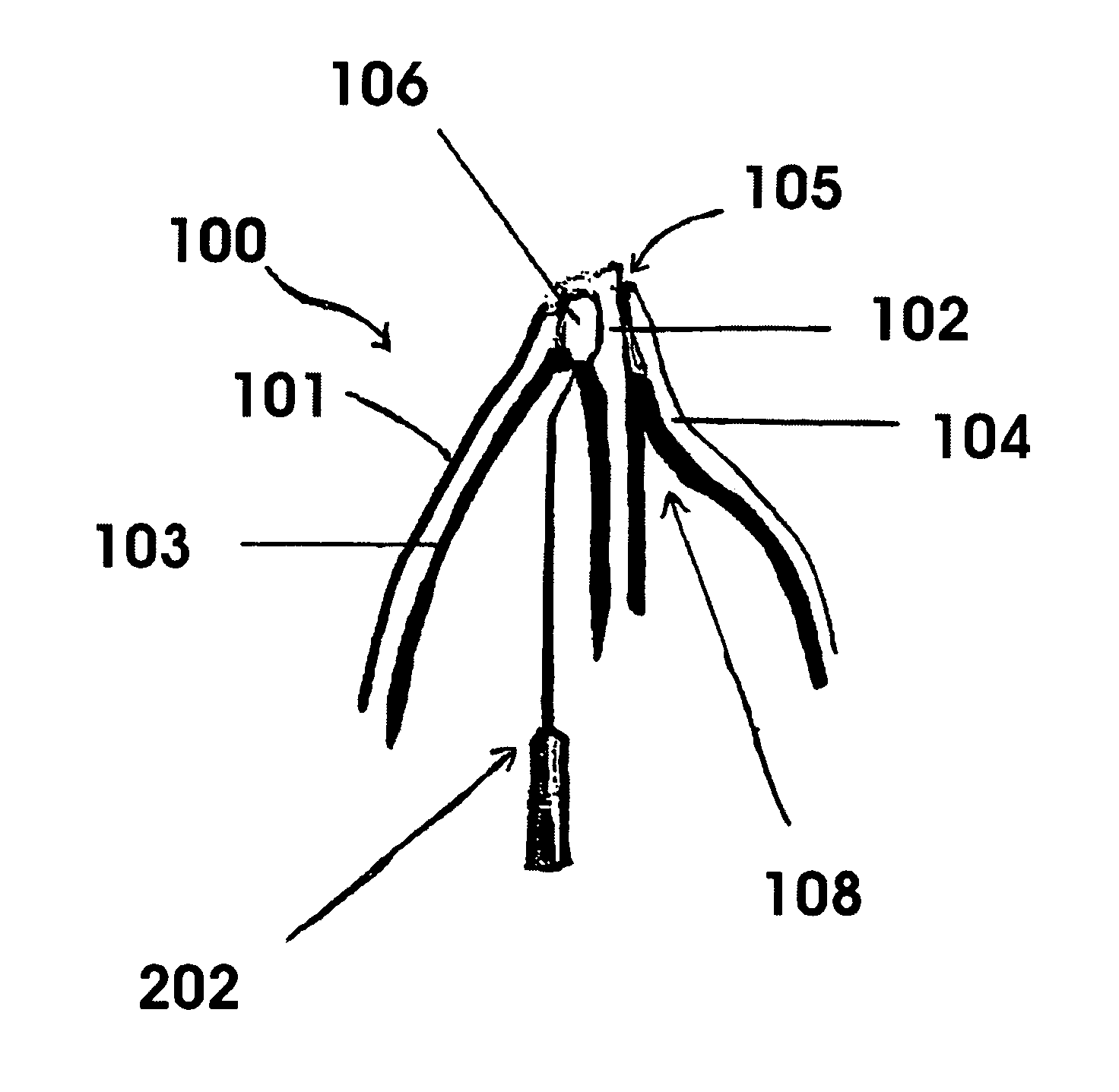 Method and system for treatment of internal nasal valves