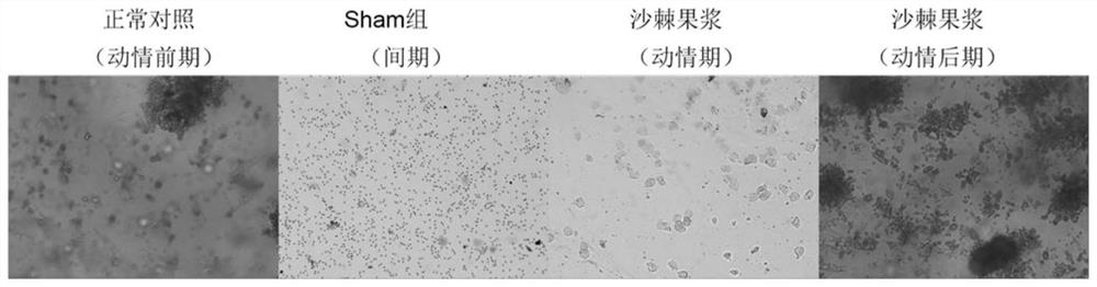 Application of sea buckthorn pulp in the prevention of polycystic ovary syndrome