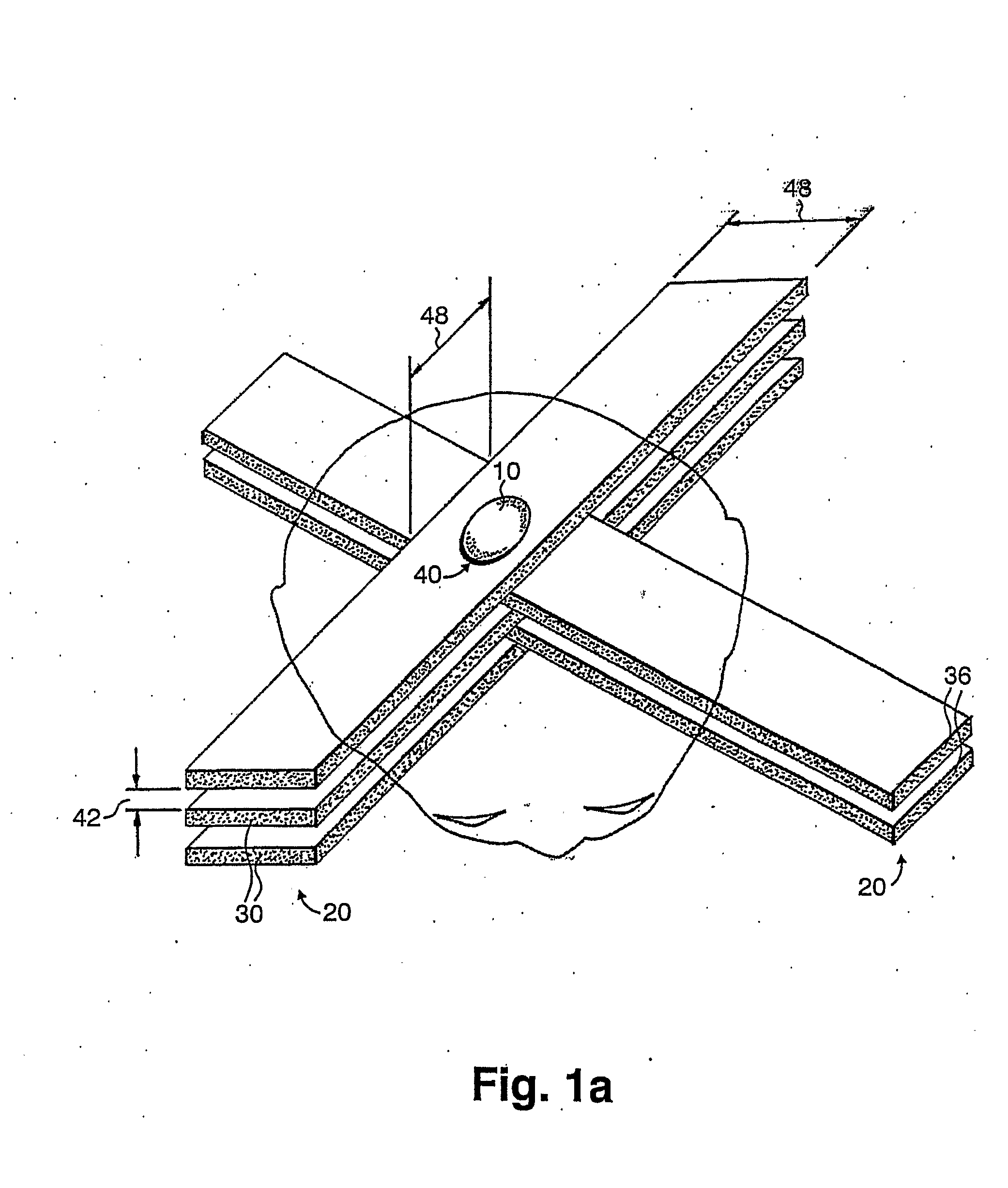 Methods for Implementing Microbeam Radiation Therapy