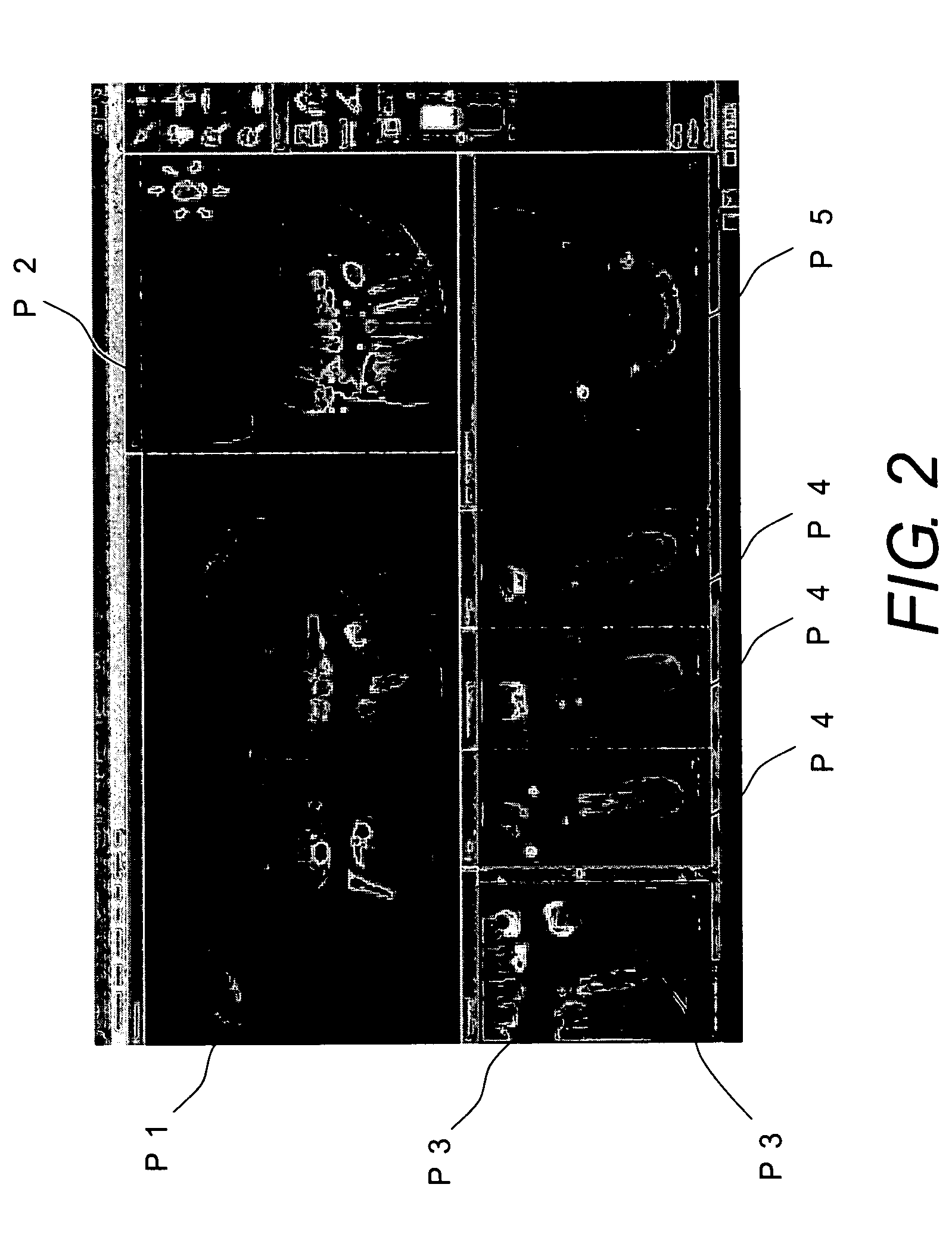 Dental treatment support system and X-ray sensor for the same