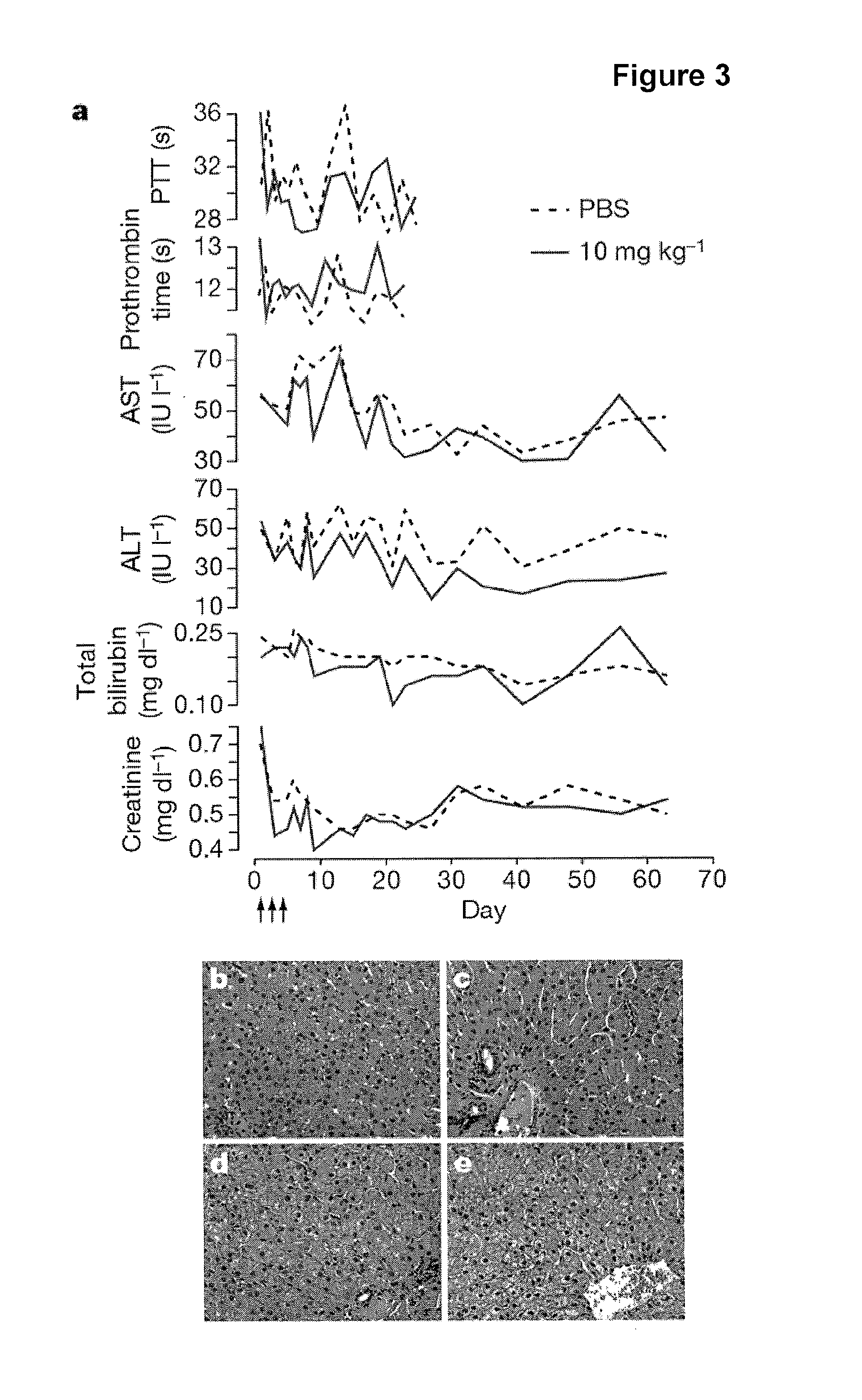Pharmaceutical compositions for treatment of microRNA related diseases