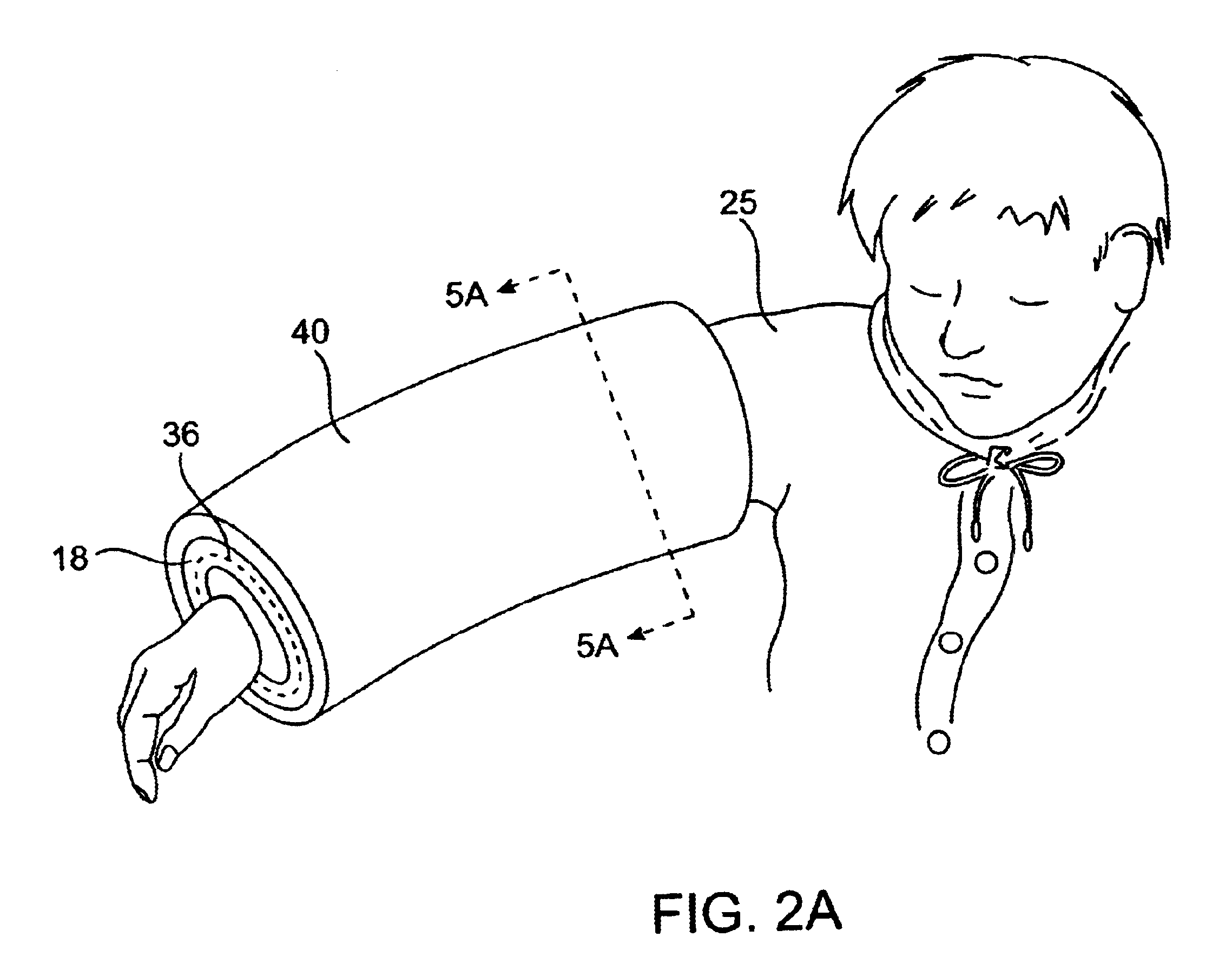 Multiple sleeve method and apparatus for treating edema and other swelling disorders