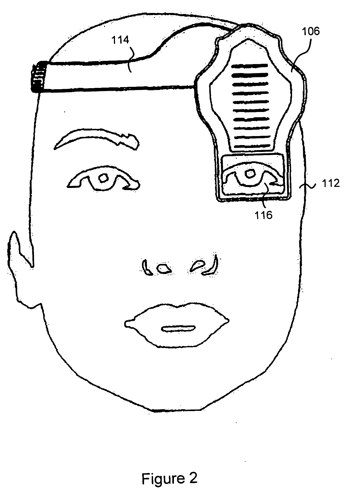 Intra-oral imaging system