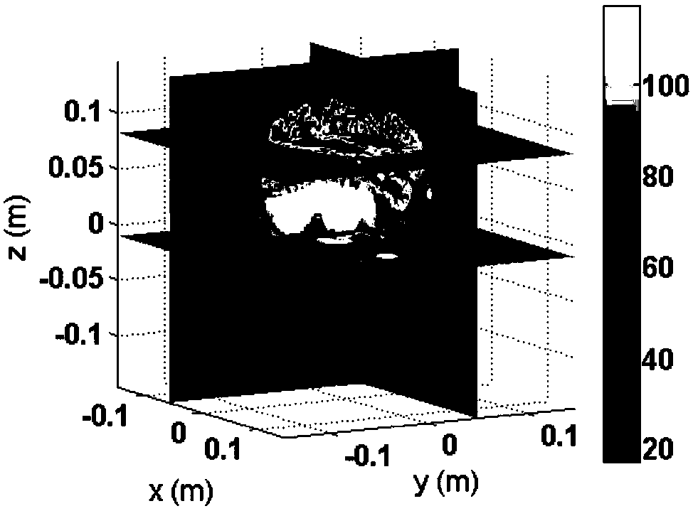 Inversion Method of Electromagnetic Properties of Human Body Based on Fast Volume Integral Equation and Magnetic Resonance