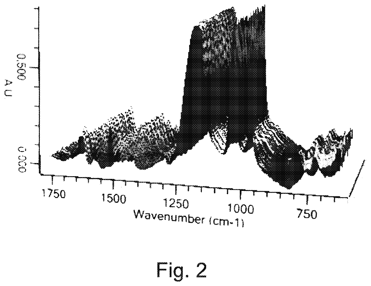 A bath and method for filling a vertical interconnect access or trench of a work piece with nickel or a nickel alloy