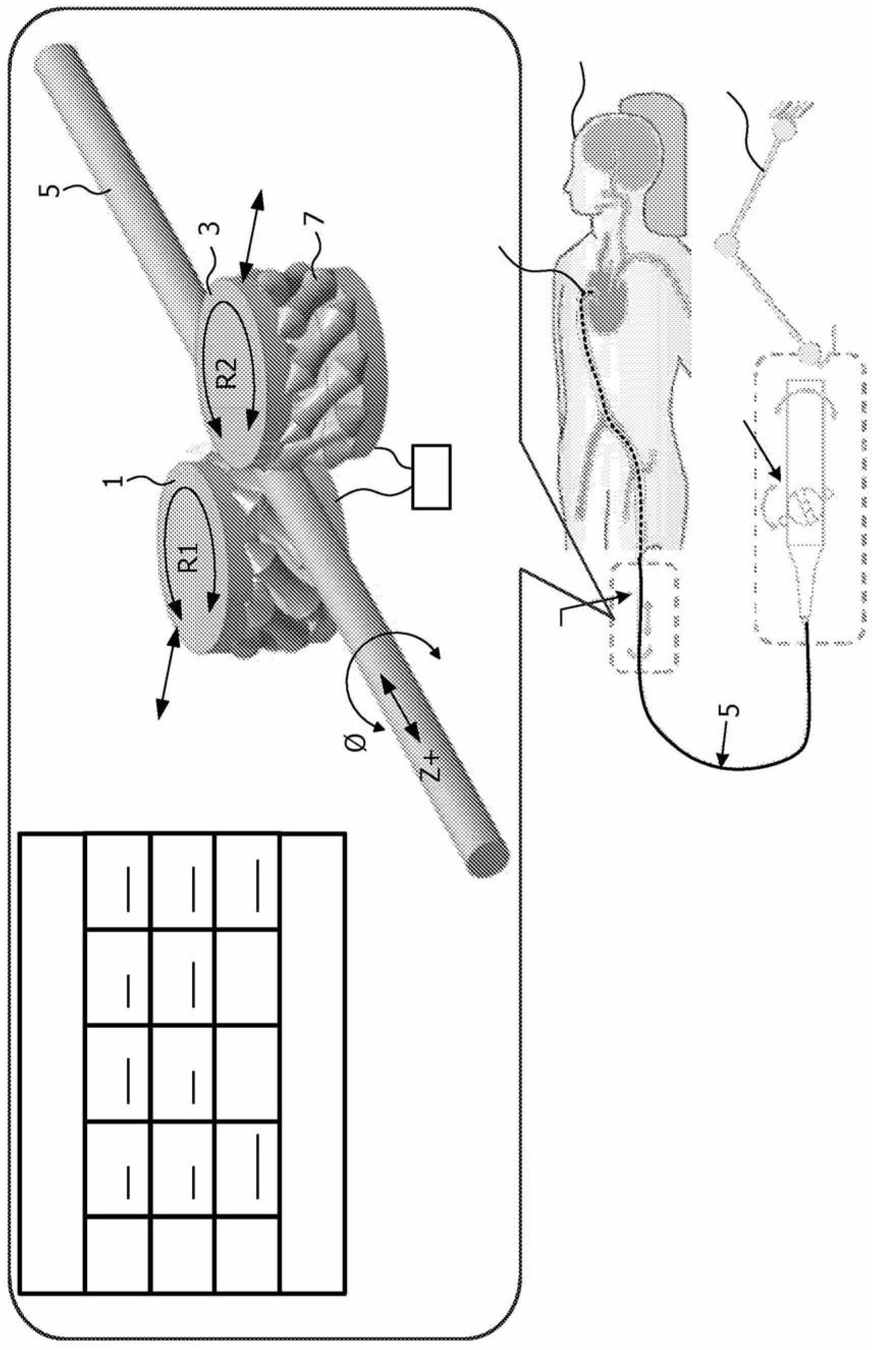 A steering system and a catcher system