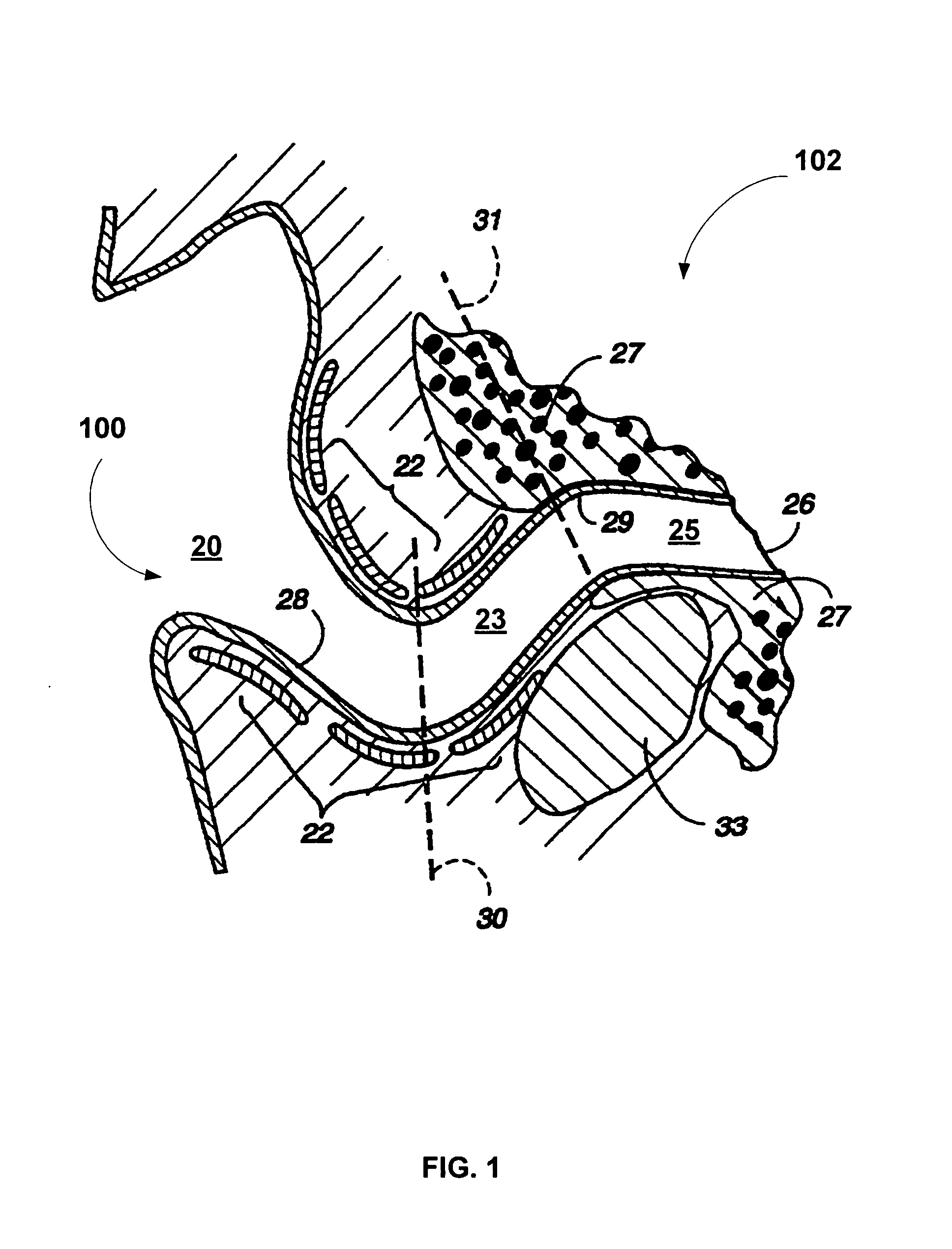 Pulse oximetry methods and apparatus for use within an auditory canal