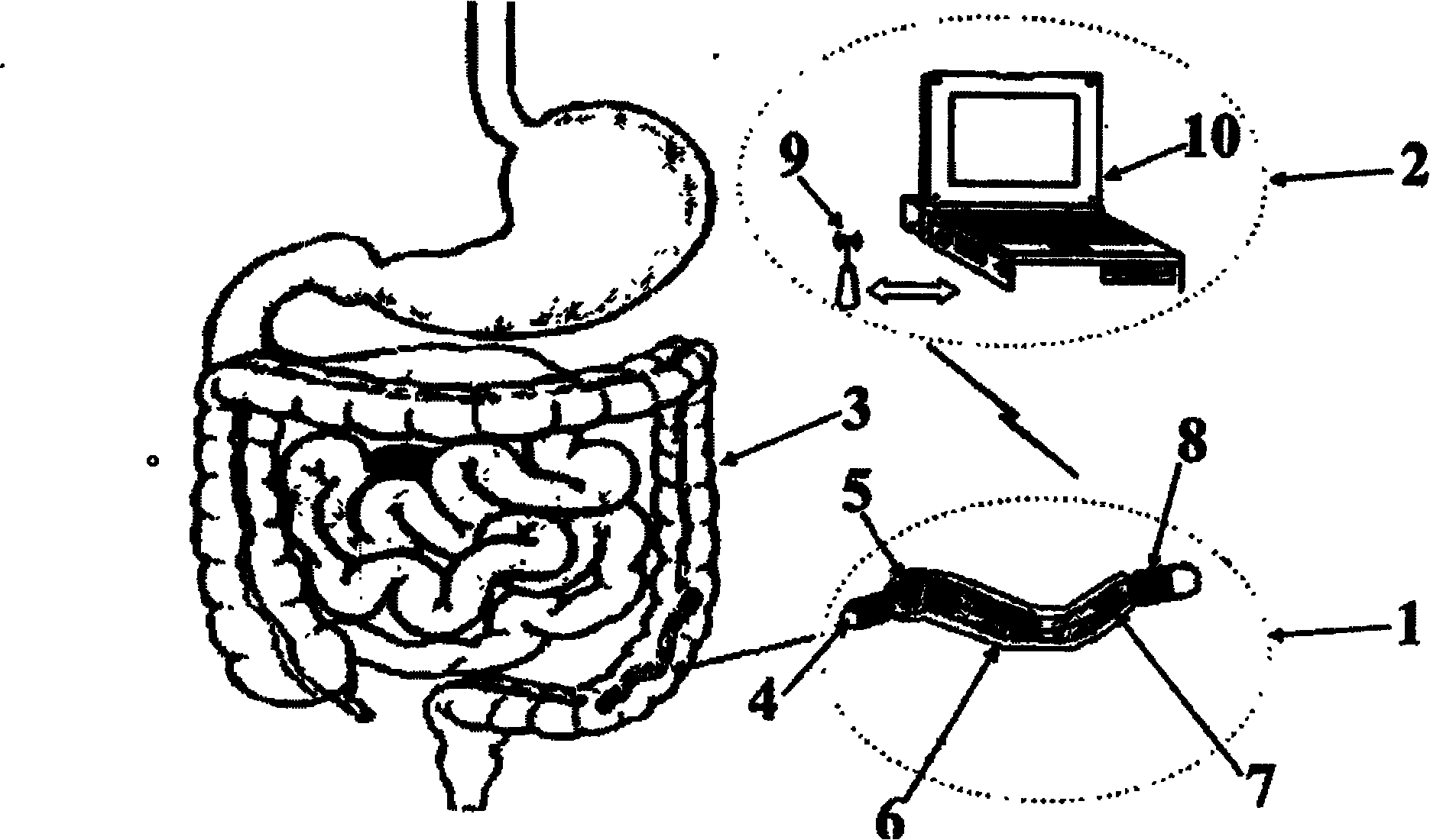 Intestinal tract diagnosis and treatment robot system