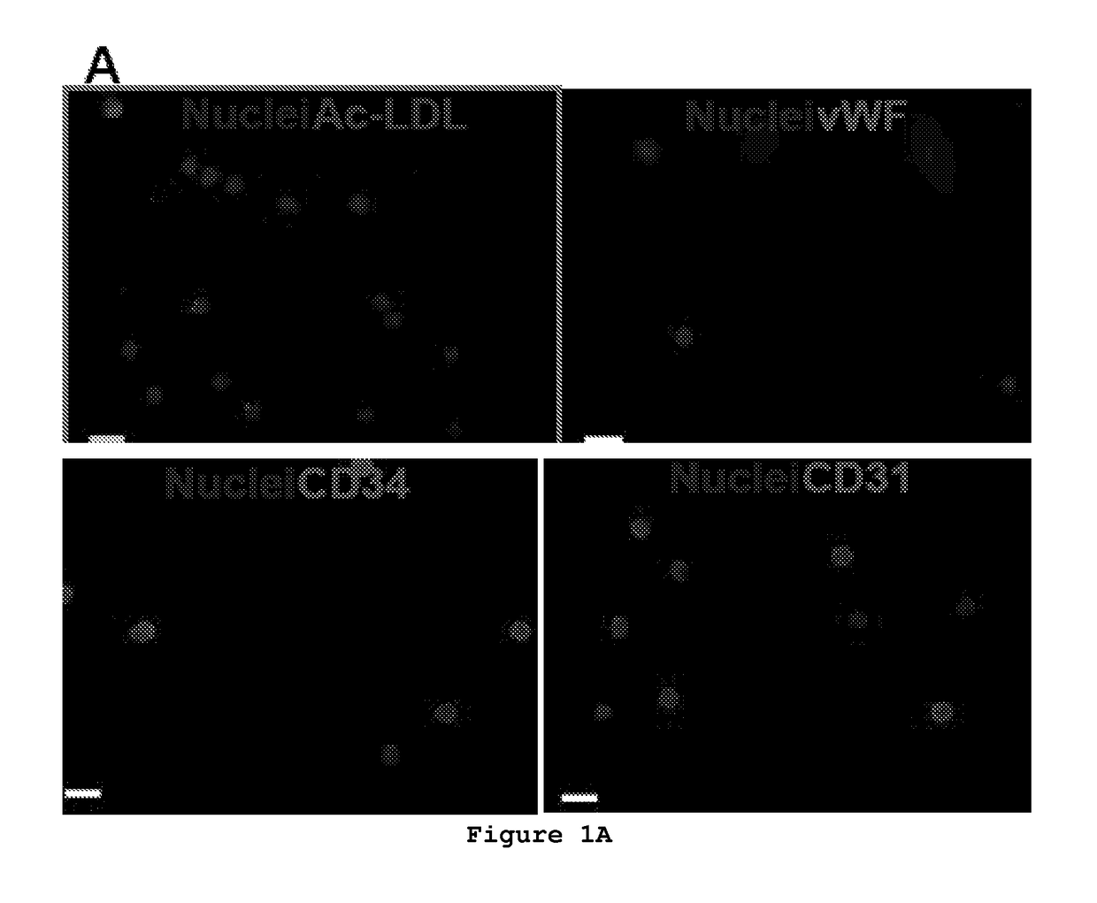 Composition and method to improve the therapeutic effect of stem cells