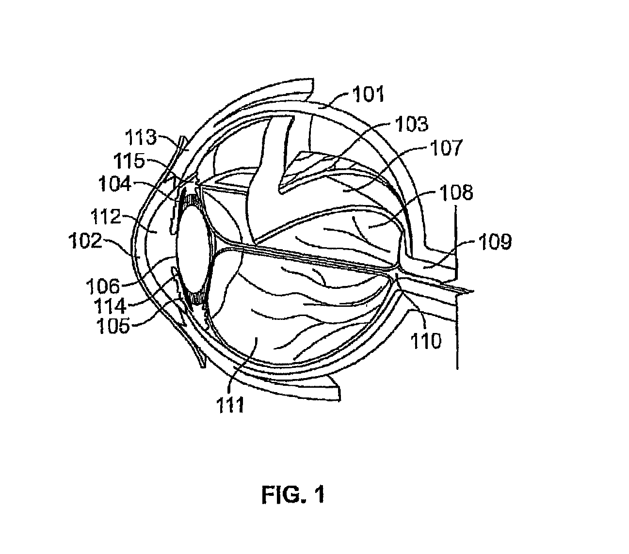 Processes and apparatus for preventing, delaying or ameliorating one or more symptoms of presbyopia