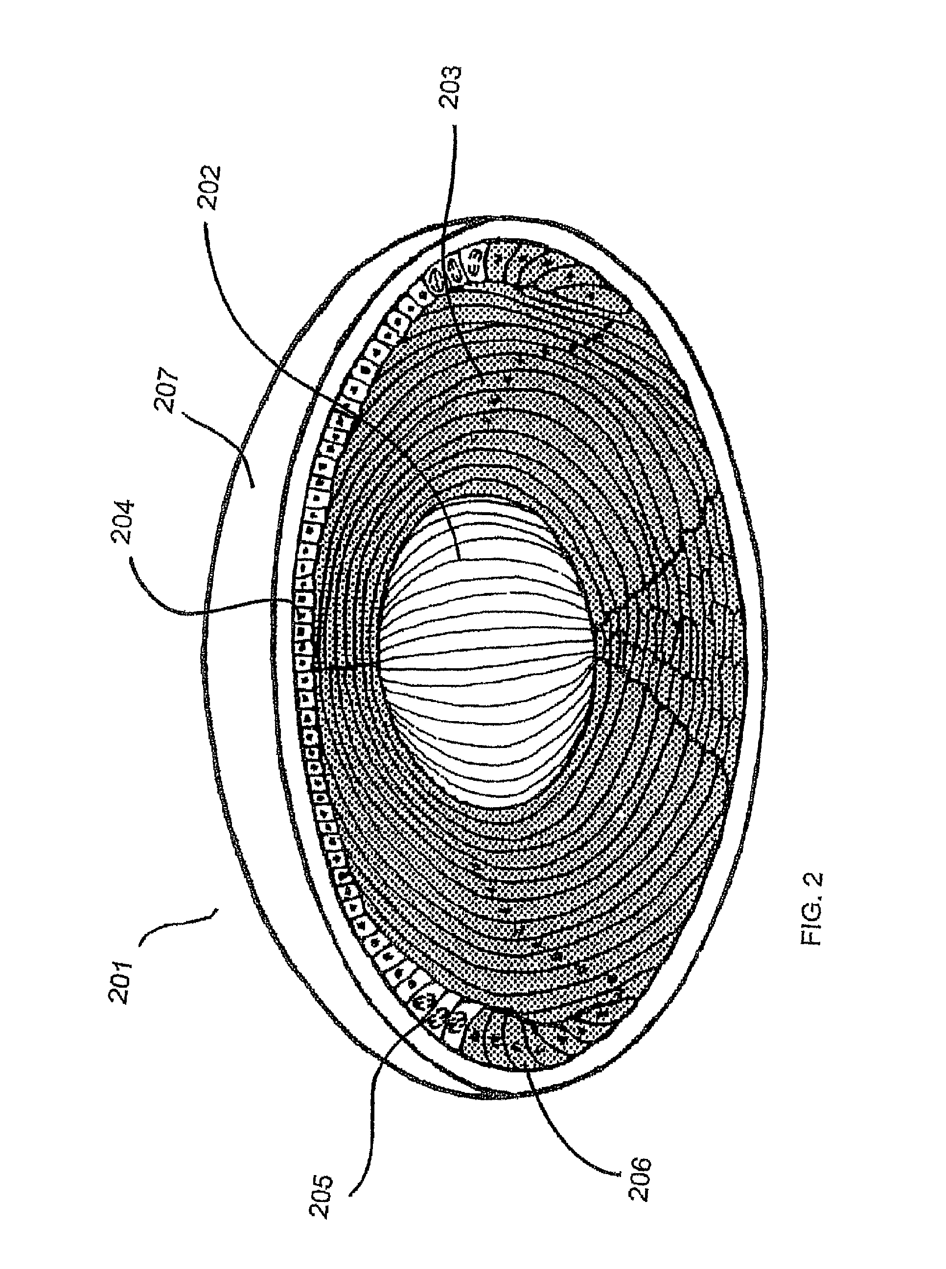 Processes and apparatus for preventing, delaying or ameliorating one or more symptoms of presbyopia
