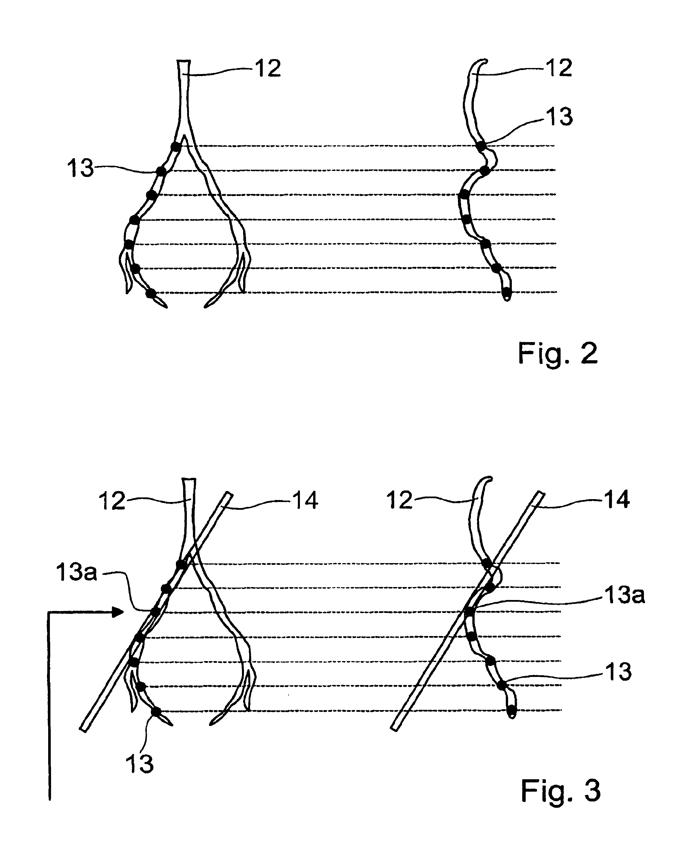 Method and system for magnetic resonance imaging