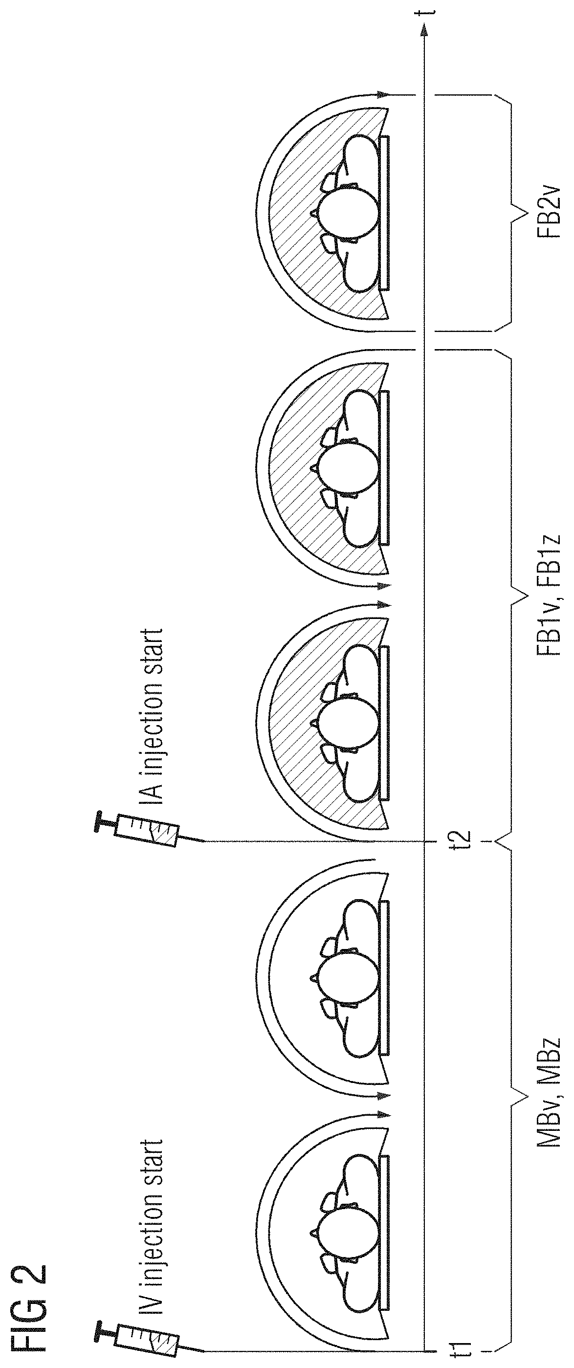 Method for producing a digital subtraction angiography and apparatus