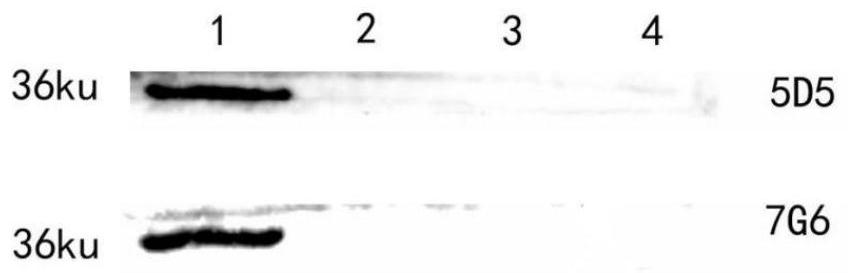 Anti-fasciola gigantica Cat L1 monoclonal antibody as well as preparation method and application thereof
