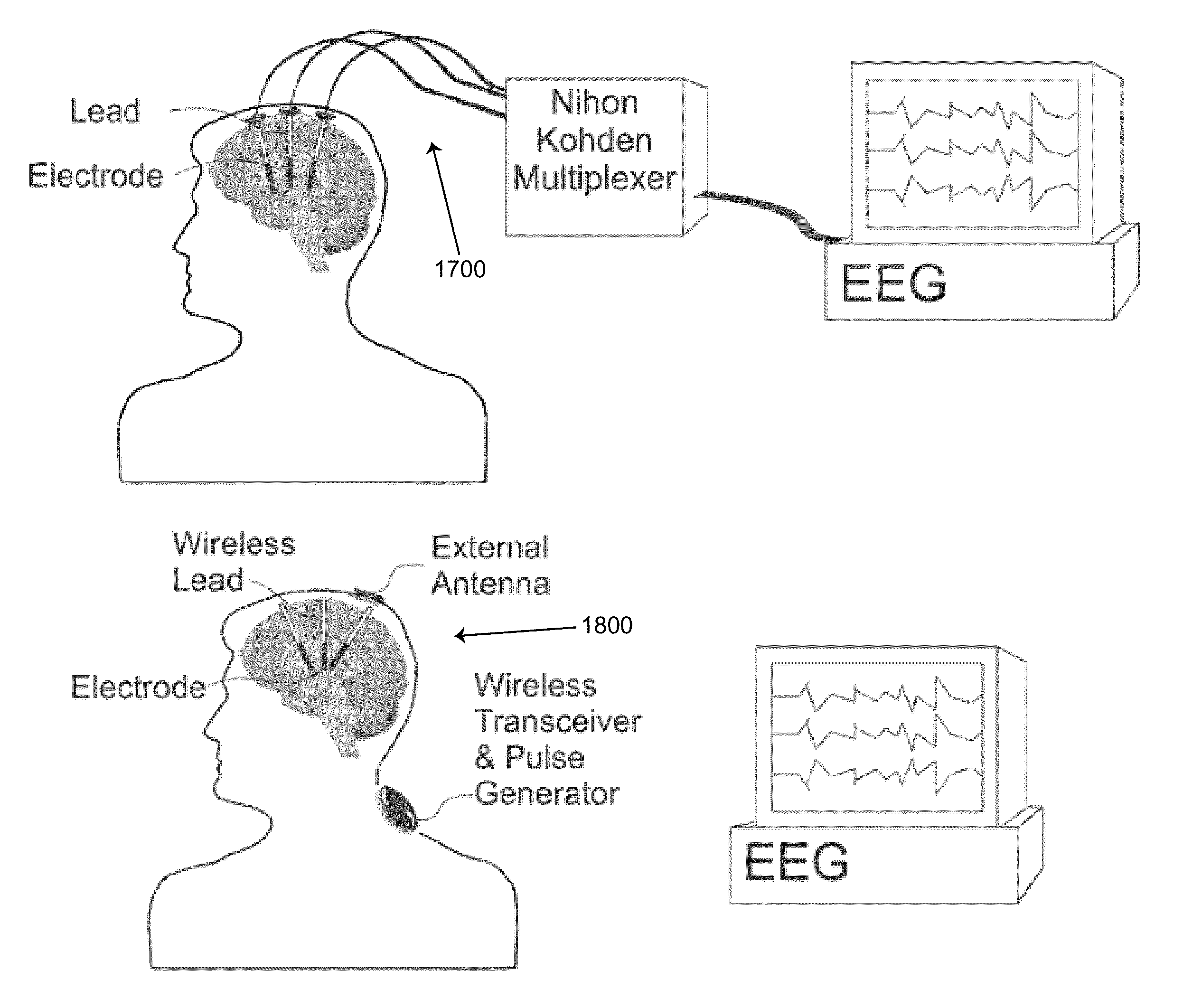 Method, system and apparatus for remote neural modulation brain stimulation and feedback control