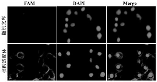 Targeted aptamer for human poorly differentiated gastric carcinoma cells and application of targeted aptamer