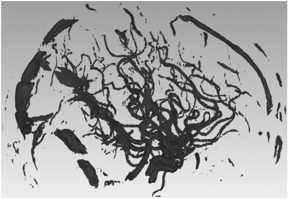 Cerebrovascular quantitative analysis method based on skeleton line